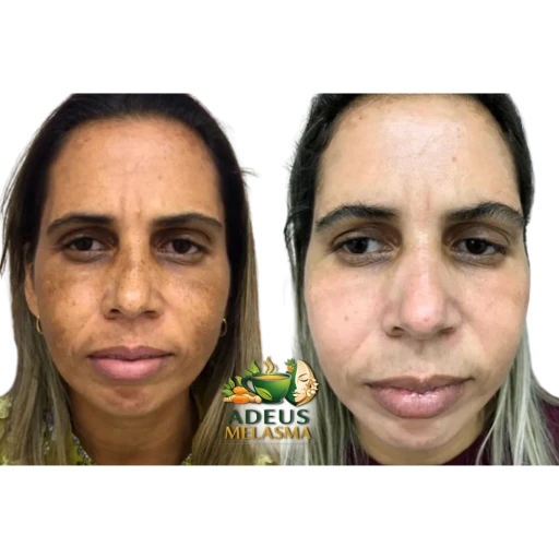 Depoimento 4
